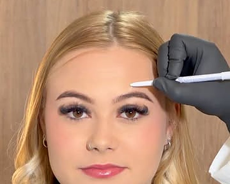 Preenchimento facial